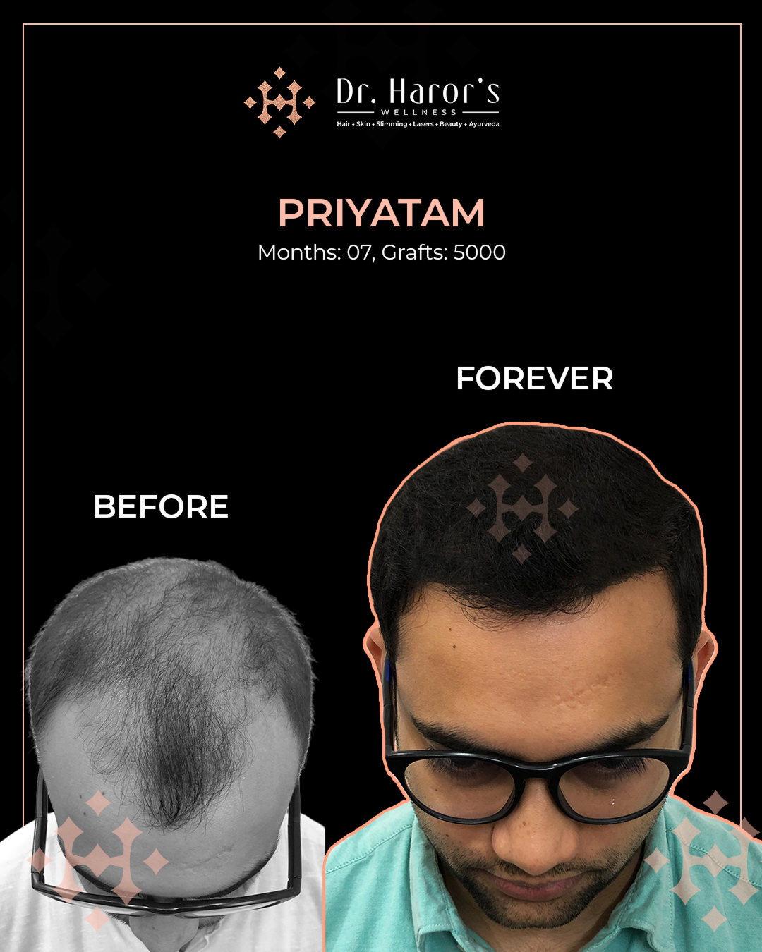 7 - Before and After